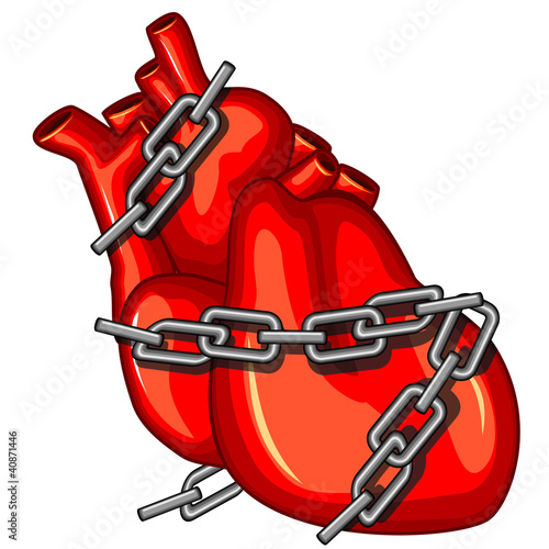 Heart attack