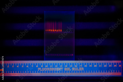 Electrophoregram of DNA separation photo
