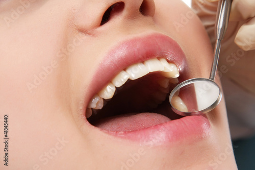 Examining patient's teeth, closeup