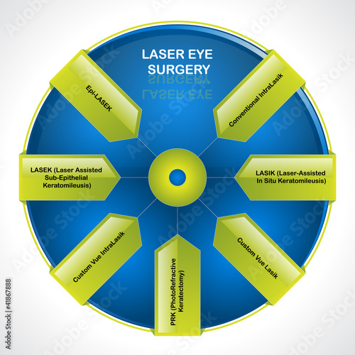 Laser eye surgery. Diagram