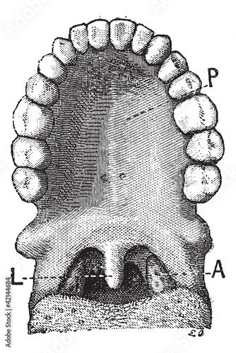 The palatine uvula or uvula, vintage engraving.