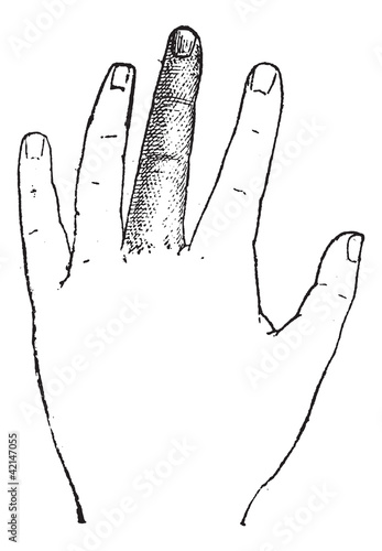 Human Middle Finger, vintage engraving photo