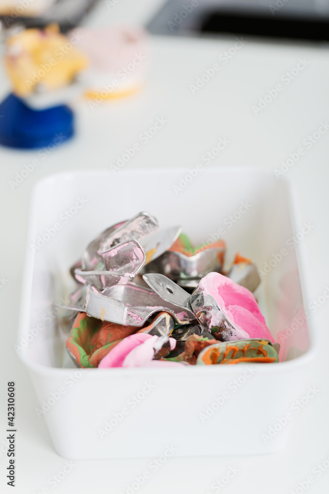 abdrücke beim zahnarzt abdrücke beim zahnarzt