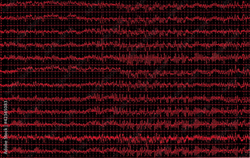 red graph brain wave eeg isolated on black background, texture red graph brain wave eeg isolated on black background, texture