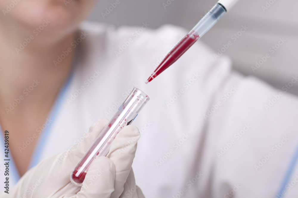 Micro pipette with blood Micro pipette with blood