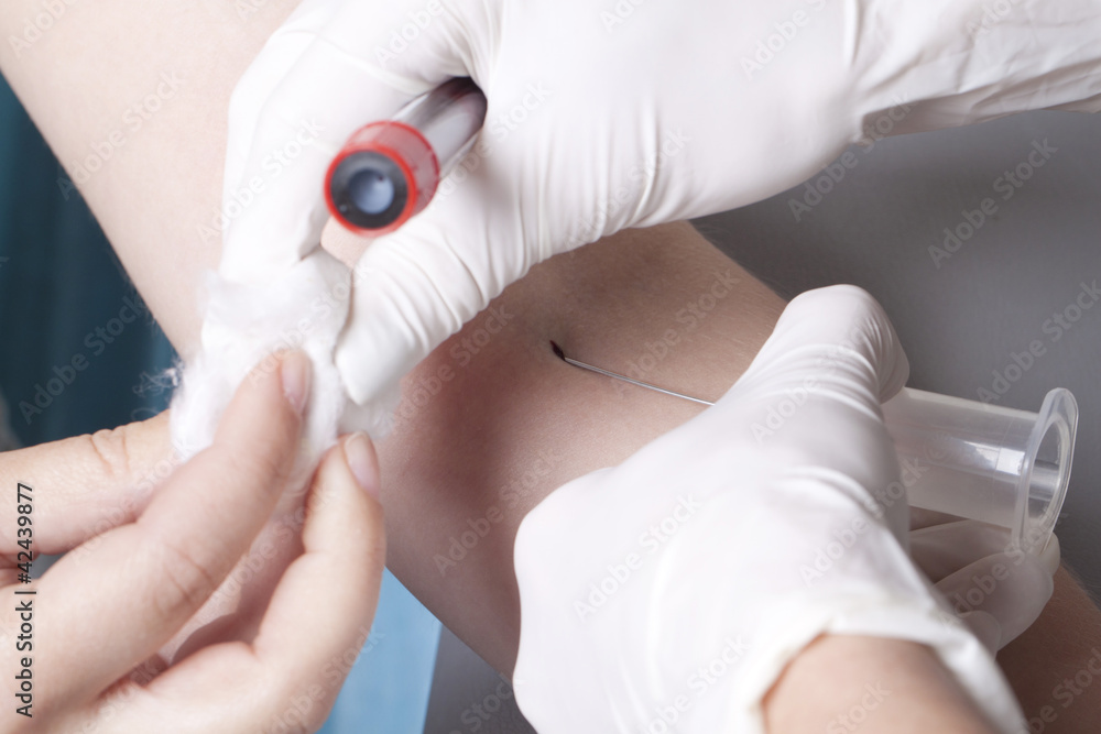 Fototapeta premium Drawing blood procedure