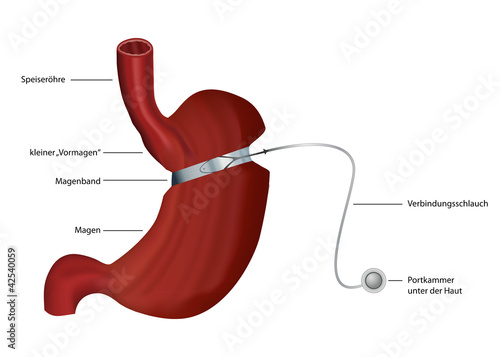 magen mit magenband vektor illustration