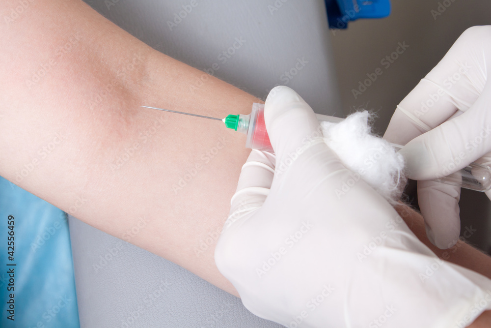 Drawing blood procedure Drawing blood procedure
