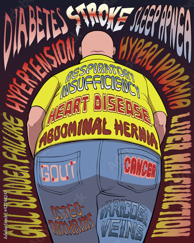 Obesity-Related Diseases