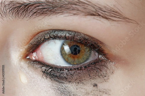 watery eye - sensitive eye of young girl - cying eye photo