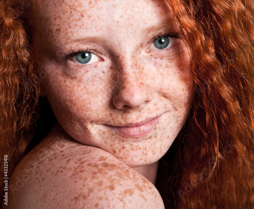 Cheerful freckled girl photo