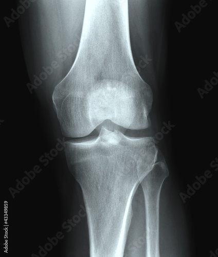 Obraz na płótnie X-ray knee w salonie
