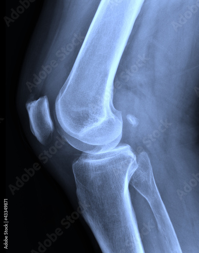 Obraz na płótnie X-ray knee w salonie