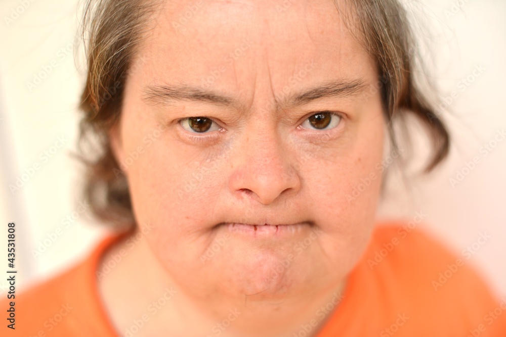 woman with down syndrome woman with down syndrome