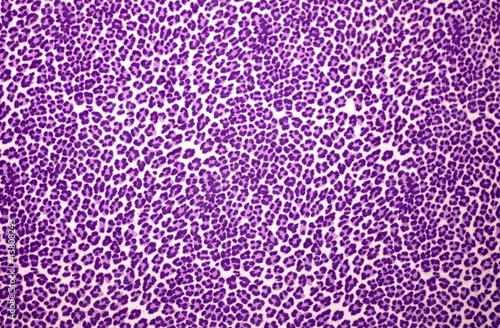 Purple Leopard Print