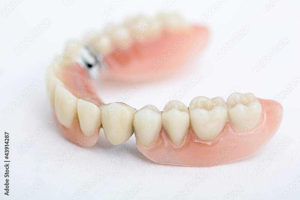 Fototapeta premium Zahnprothese