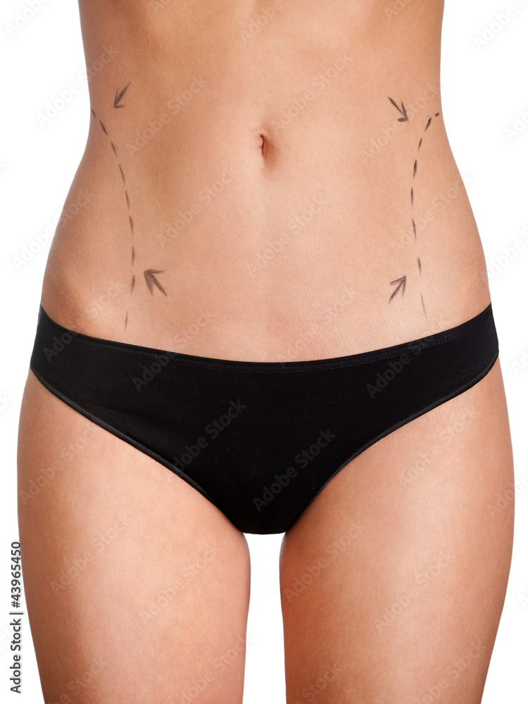 Body correction, isolated, white background Body correction, isolated, white background