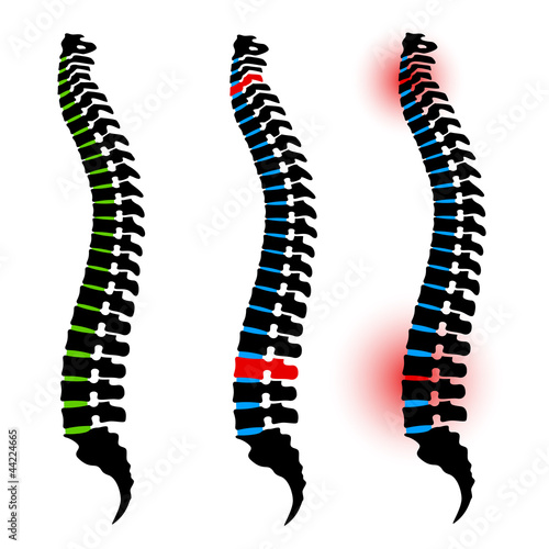 vector human spine silhouettes