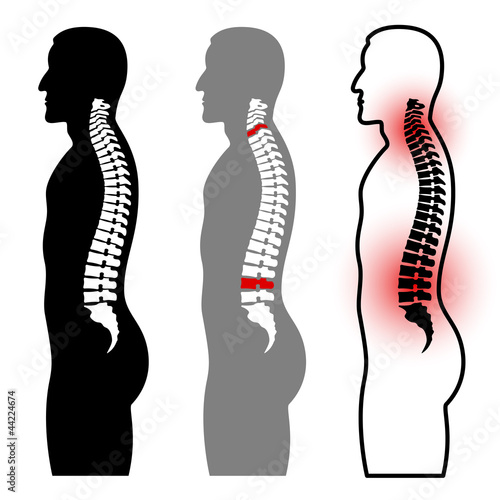 vector human spine silhouettes