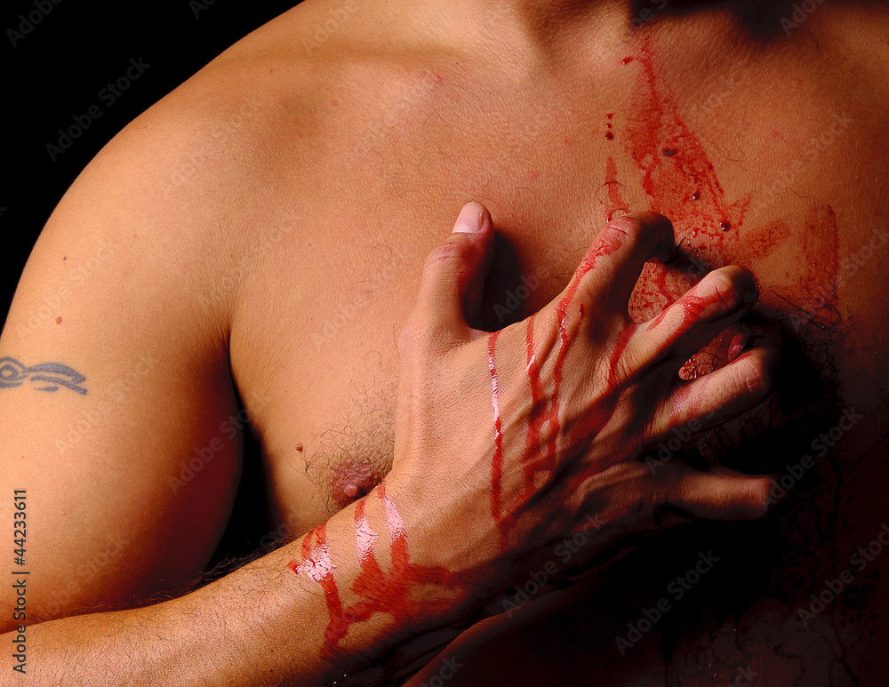 Bloody hand