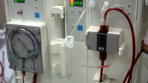 Arlificial kidney (dialysis) medical device with rotating pumps photo