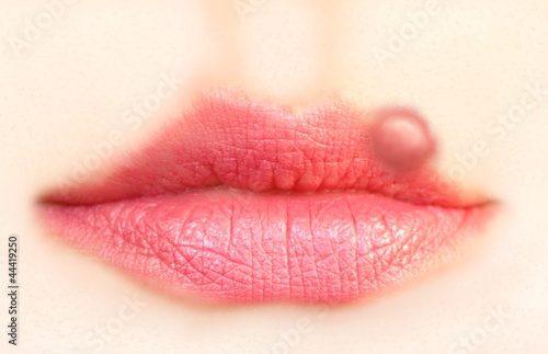 Close up of lips affected by herpes (cold sore)