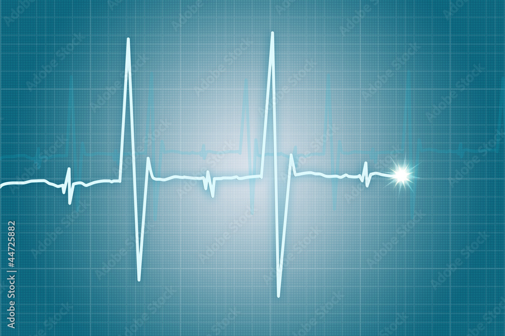Heart beat cardiogram