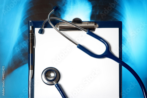 Empty document in a clipboard with stethoscope and Xray photol photo