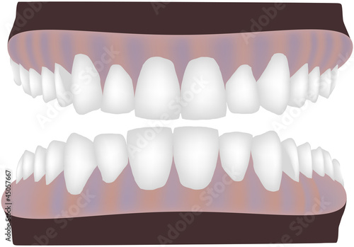 dental apparatus