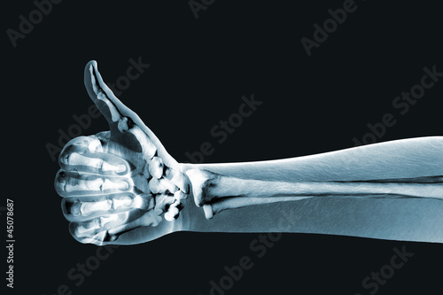 dramatized x ray of a hand thumbs up