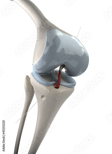 Φωτογραφία Knee artroscopy stage 2