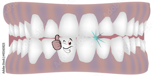 dentiera pulita