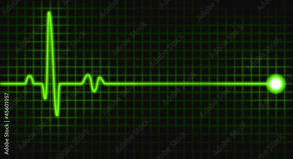 pulse graph pulse graph