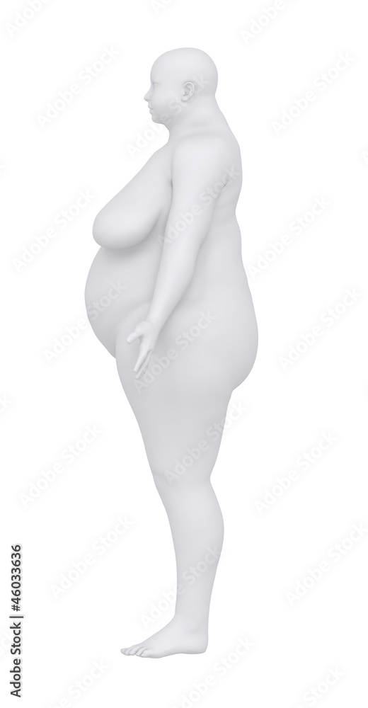 Obese woman in anatomical position lateral view Obese woman in anatomical position lateral view