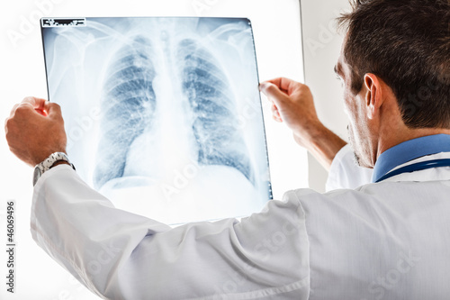 Doctor examining a radiography photo