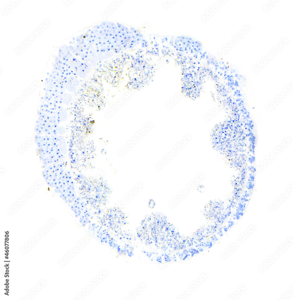 Hydra under the microscope, background Hydra under the microscope, background