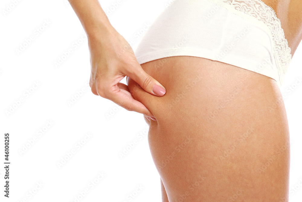A woman showing cellulite skin on nates