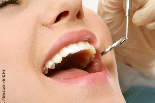 At the dentist's, closeup photo