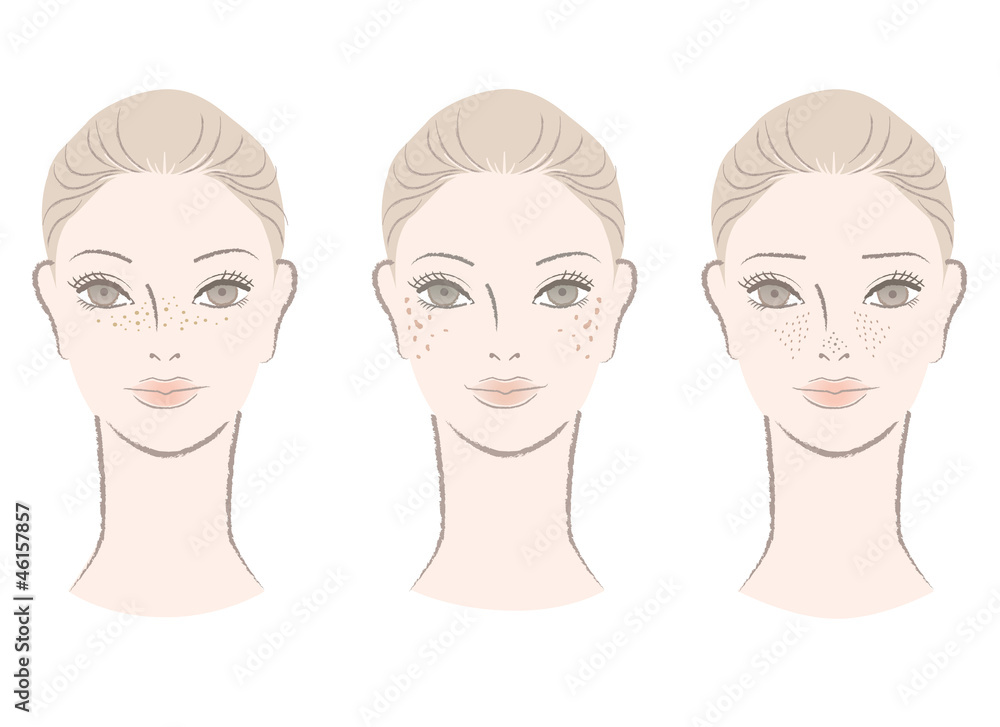シミ 毛穴の開き そばかす イラスト 女性 美容 Stock Photo Adobe Stock