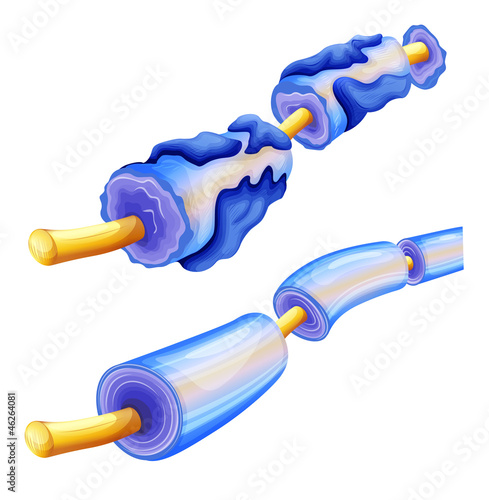Myelin deterioration