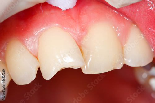 Teeth needing medical attention - part of portfolio photo