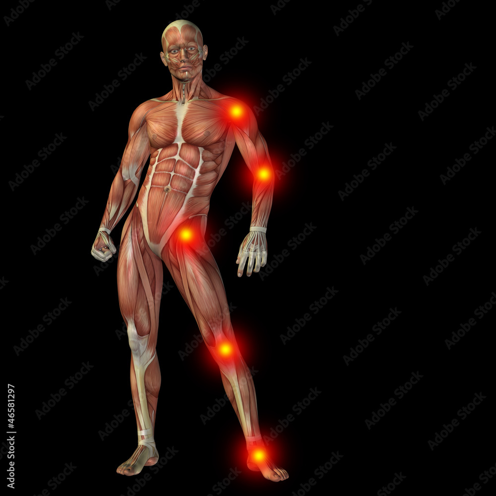 High resolution conceptual 3D human with inflammation High resolution conceptual 3D human with inflammation