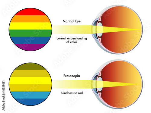 protanopia photo