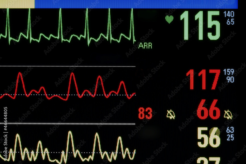 Obraz premium Medical Monitor. Close-up photos.