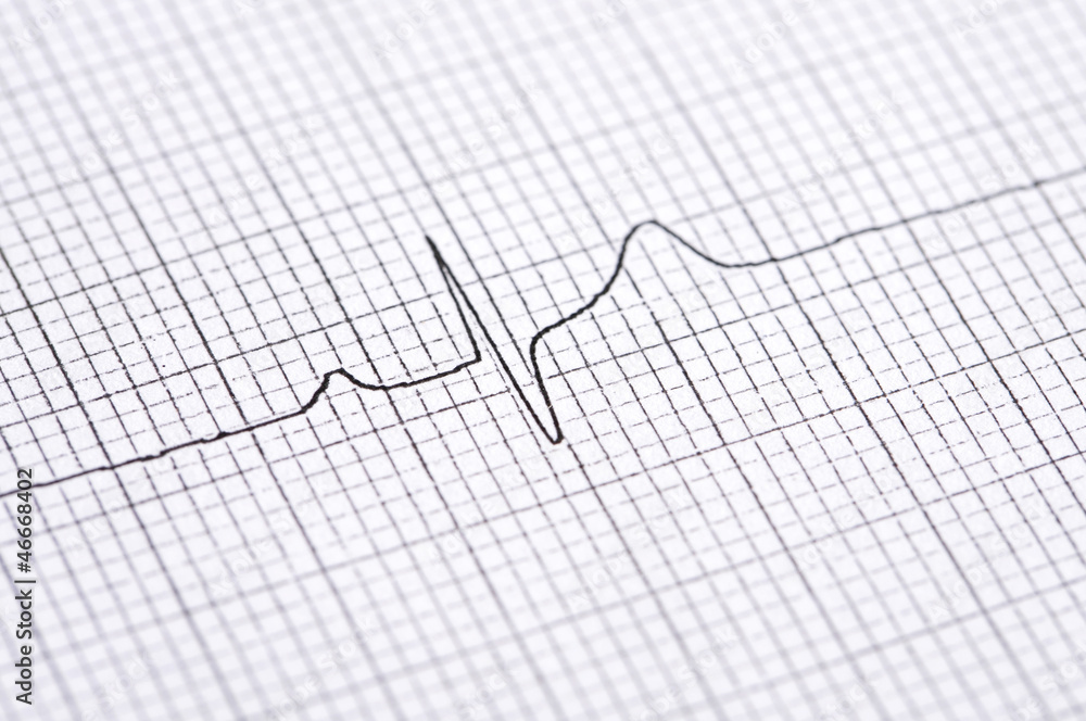 Electrocardiogram graph Electrocardiogram graph