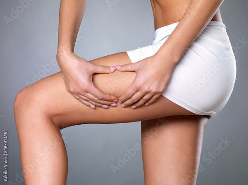 Fotografija cellulite skin on her legs