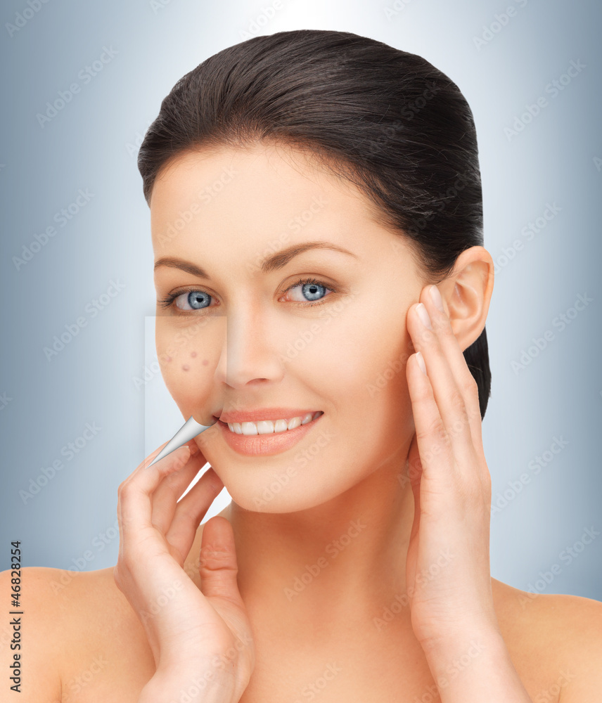 no more acne no more acne