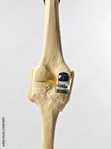 anatomic study model of an human knee replacement