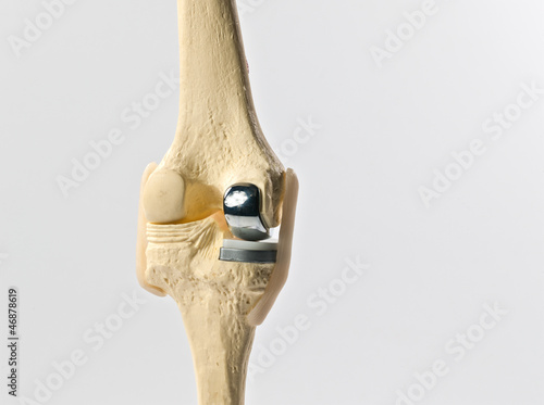 anatomic study model of an human knee replacement