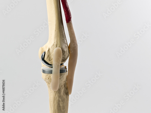 anatomic study model of an human knee replacement